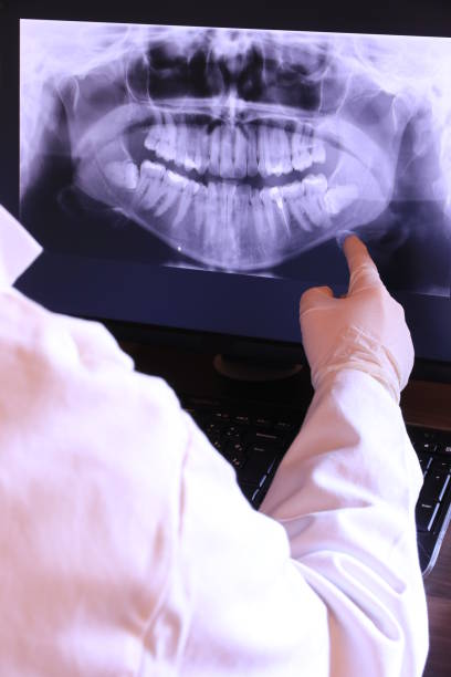 Best Emergency Root Canal Treatment in Springfield, SD